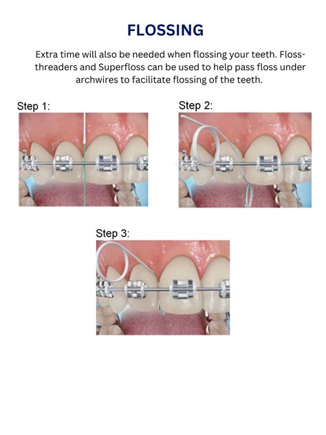 5 braces flossing tips