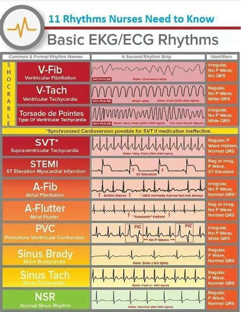 ACLS Cheat Sheet Basics Image 8