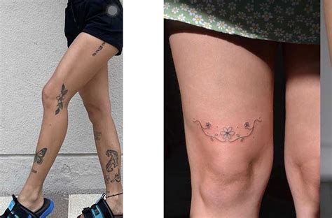 Above The Knee Tattoo Removal