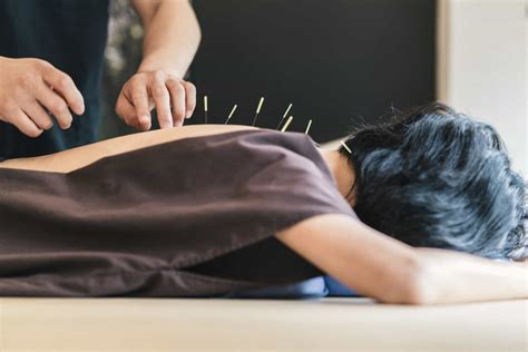 Acupuncture Treatment