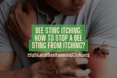 Bee Sting Itching