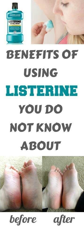 Benefits of Using Listerine