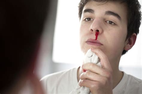 A person looking confused and concerned about a bloody nose