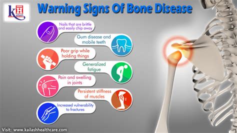 Description of Bone Diseases