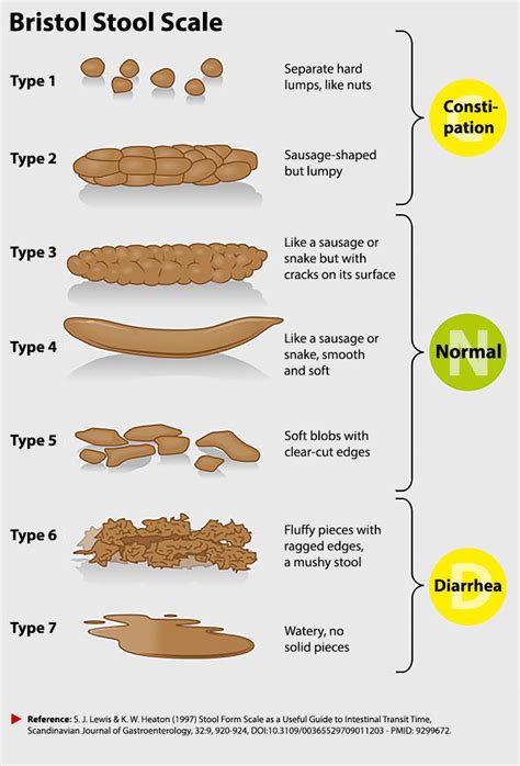 Bristol Stool Chart Type 1