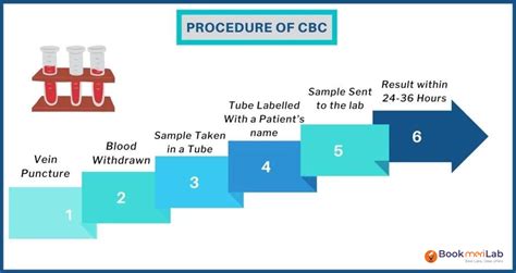 CBC Test Procedure Protocol