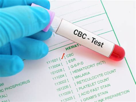 CBC Test Procedure