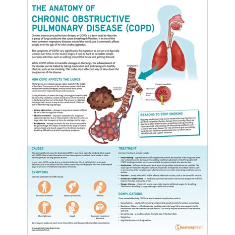 COPD Management