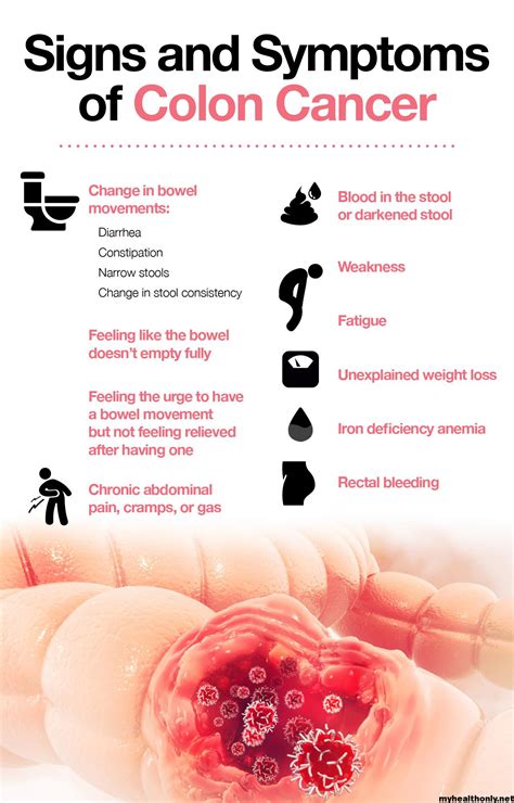 Colon Cancer Symptoms