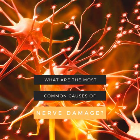 Common Causes of Nerve Damage or Disease