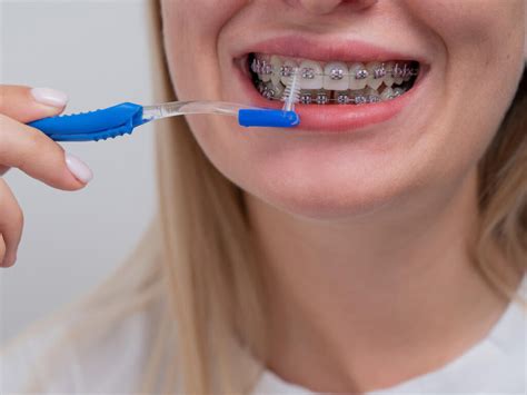 Common mistakes to avoid when flossing with braces