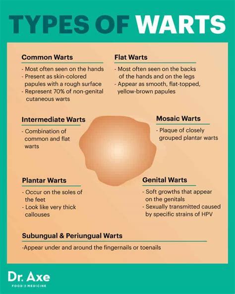 Common Mistakes to Avoid When Treating Warts