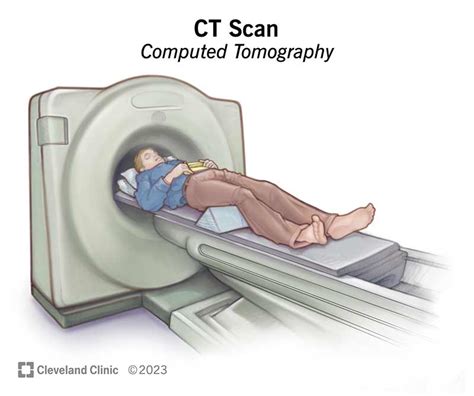 Computed Tomography Image