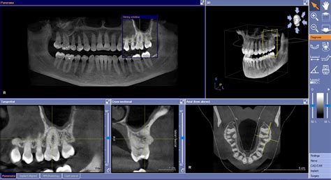 Computed Tomography Image