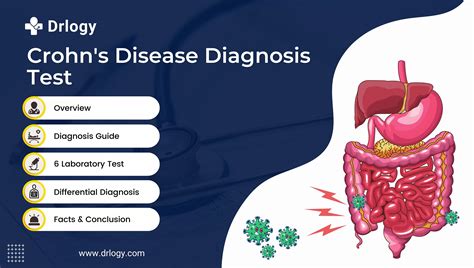 Crohn's Disease diagnosis