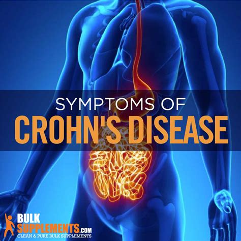 Crohn's Disease symptoms