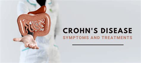 Crohn's Disease treatment options