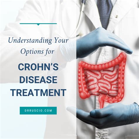 Crohn's Disease treatment options