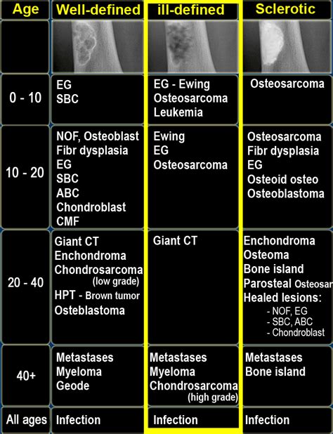 Diagnosis of Destructive Osseous Lesions