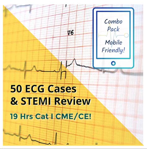 ECG Case Studies