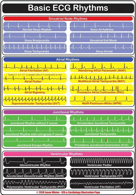 ECG Cheat Sheet for Nurses and Medical Students