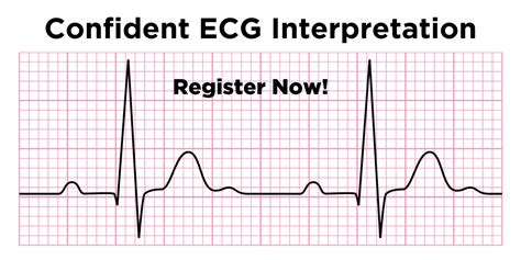 ECG Interpretation Pitfalls