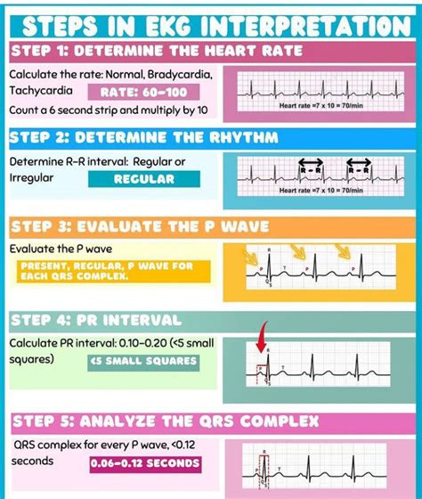 ECG Interpretation Steps