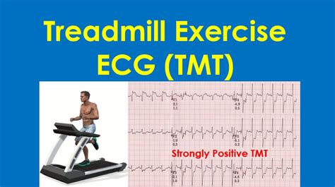 ECG Practice Exercises