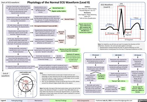 EKC Lead II Practice Guide