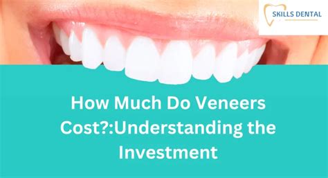 Factors that influence veneer costs