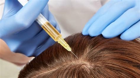 Hair Loss Treatment