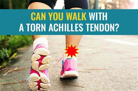 Heel Walks for Achilles Tendon