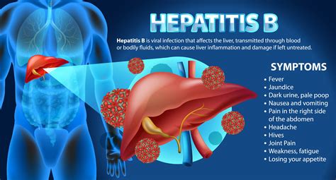 Hepatitis