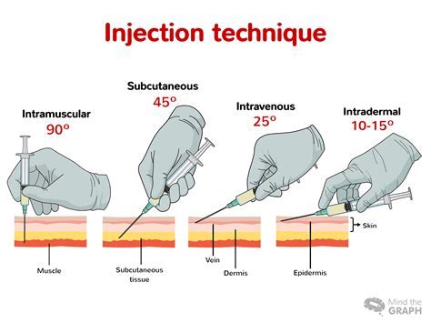 Injection Technique