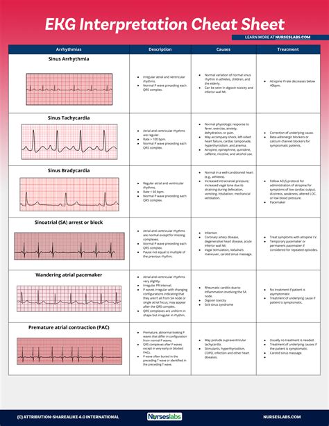 Interpreting ECG Readings Example