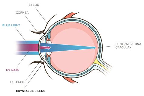 Macular Degeneration and Blue Light Exposure