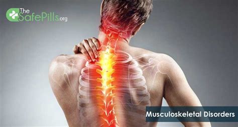 Musculoskeletal Conditions