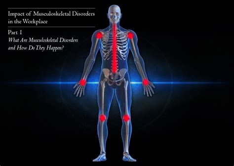 Description of Musculoskeletal Disorders