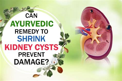 Natural Remedies for Kidney Cysts