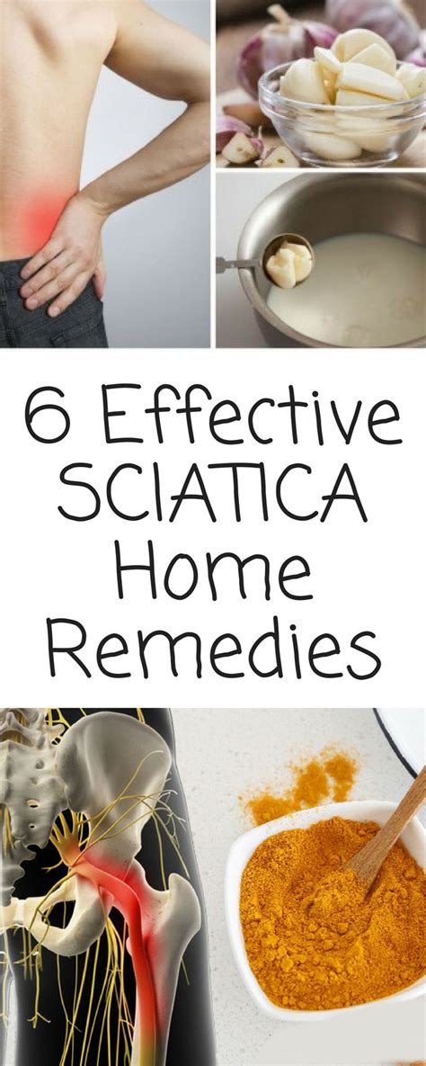 Natural Remedies for Sciatica