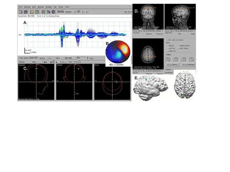 Neuro-Mag Research