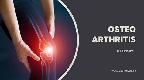 Osteoarthritis Condition