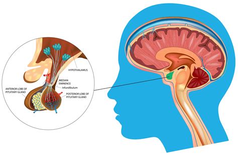 Pituitary Gland Problems and Amenorrhea