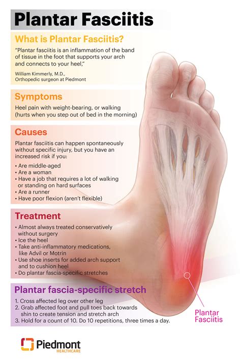 Plantar Fasciitis Symptoms