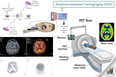 Positron Emission Tomography Image