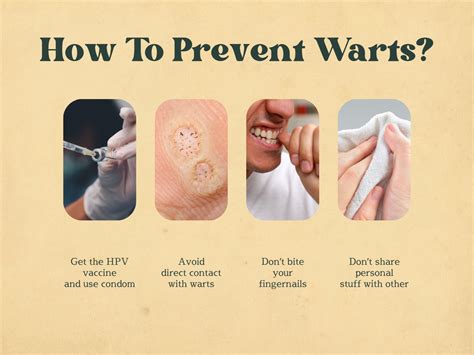 Preventing Warts