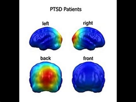 Psychological Effects of Pear Torture