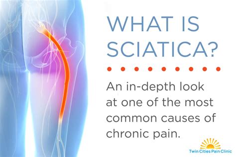 Sciatic Nerve Pain