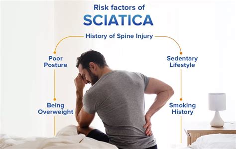 Sciatica Causes and Risk Factors