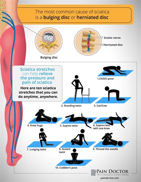 Description of Sciatica Pain Relief Options